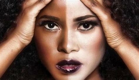 7 HARMFUL EFFECTS OF SKIN BLEACHING CREAMS | Bebe Afrikana