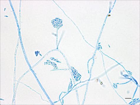 Fusarium spp. | Institut national de santé publique du Québec