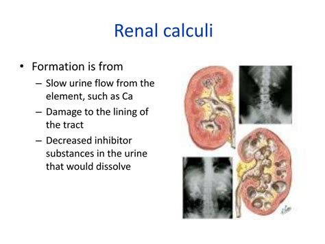 PPT - Management of Patients with alterations in the Renal system PowerPoint Presentation - ID ...