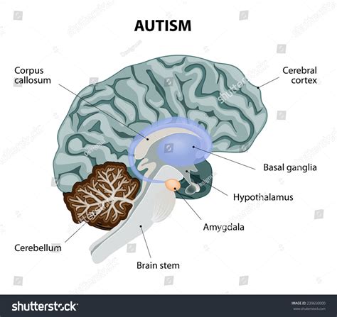 5,058 imágenes de Autistic brain - Imágenes, fotos y vectores de stock ...