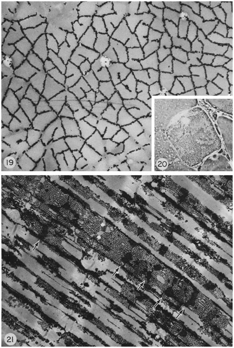 In this muscle fiber from a crab, both T tubules and SR have been... | Download Scientific Diagram