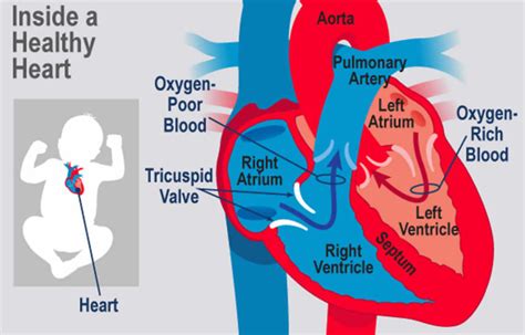 Tricuspid atresia causes, symptoms, diagnosis, treatment & prognosis