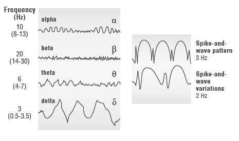 What happens during an electroencephalogram (EEG)?