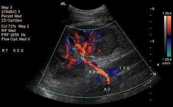 Gynecology pelvic ultrasound made easy step by step guide – Artofit