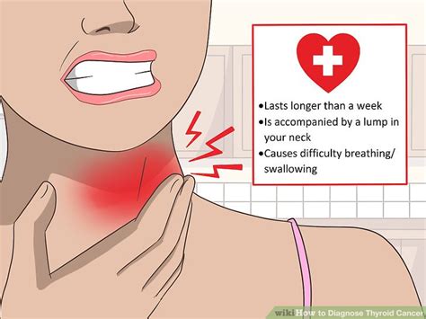 How to Diagnose Thyroid Cancer (with Pictures) - wikiHow