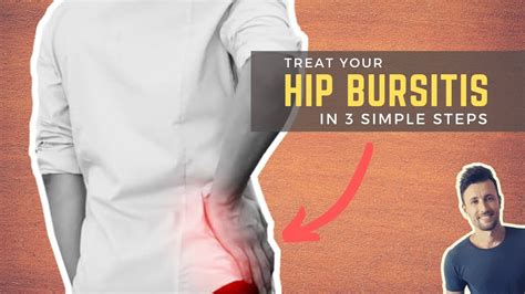 Fix Hip Bursitis In Simple Steps Bursitis Hip Bursitis Hips | The Best Porn Website