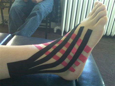 Kinesio Tape Ankle Sprain