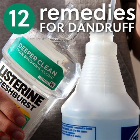 12 Homemade Dandruff Treatments & Shampoos | Everyday Roots