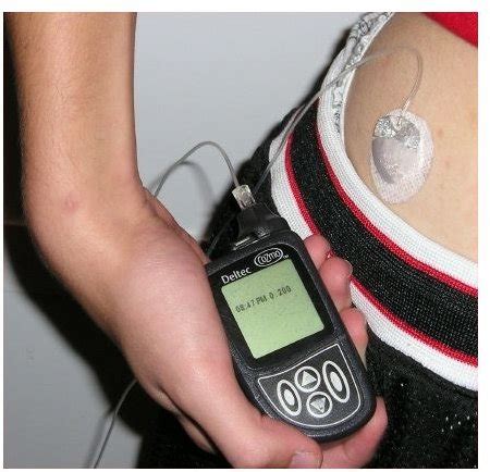 An Insulin Pump Comparison Guide - Health Guide Info