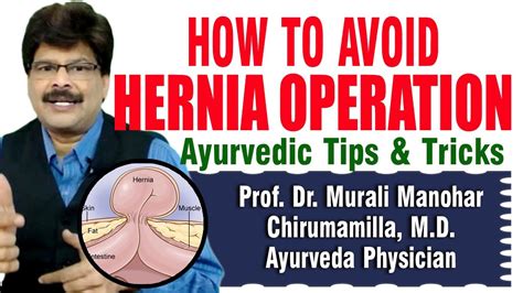 How to Avoid Hernia Operation | Prof. Dr. Murali Manohar Chirumamilla, M.D. (Ayurveda ...