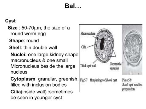 BALANTIDIUM COLI.ppt | Free Download