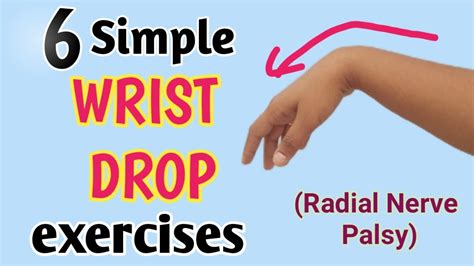 wrist drop exercises in hindi | radial nerve palsy exercises - YouTube