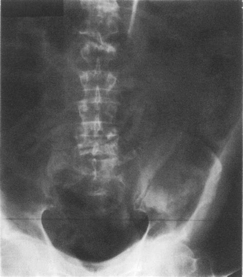 Rigid, distended abdomen on arrival in the A&E department. | Download Scientific Diagram