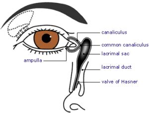 Nasolacrimal Duct Obstruction - OasisEye Specialists