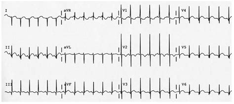 Differential Diagnosis of ECG Guide: Pediatrics