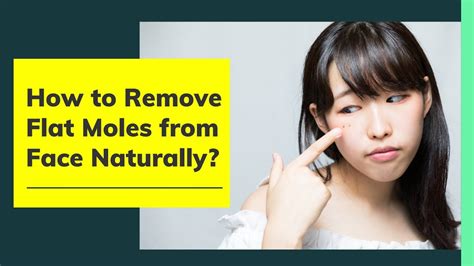 How to Remove Flat Moles from Face Naturally at Home - 7 Quick Tips - YouTube | Moles on face ...