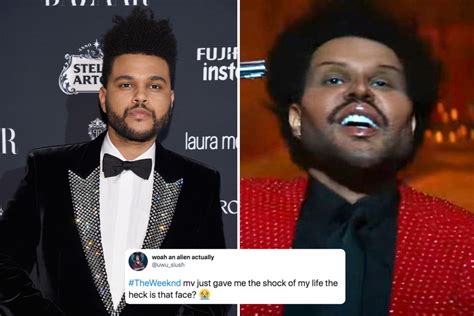 The Weeknd fans 'scared' after debuting face from ‘plastic surgery’ in ...