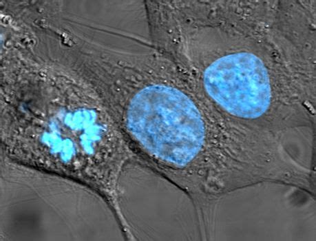 Cell nucleus - Wikipedia