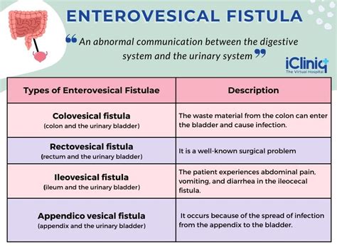 What Are the Treatment Options for Enterovesical Fistula?