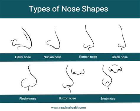 Types of Noses by Race - Raadina Health in 2024 | Nose shapes, Greek ...