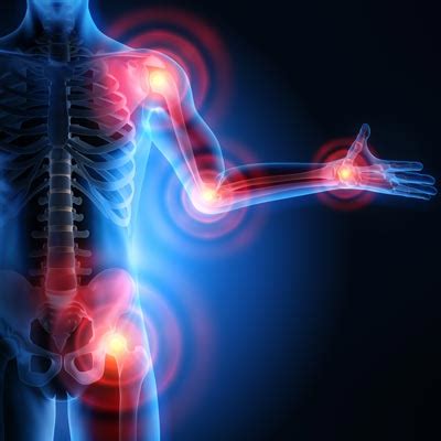 How Chiropractic Treatment Affects Inflammation in the Bones, Organs, and Joints – Chiropractic ...