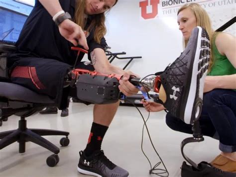 The Most Advanced AI-powered Prosthetics 'Ever Created'