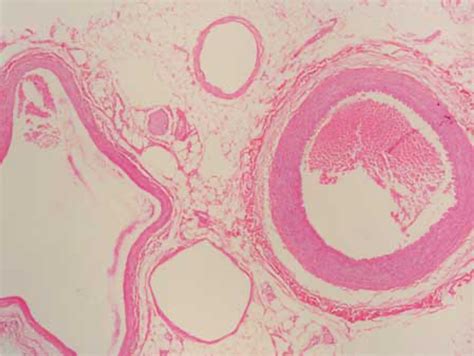 Vein and Artery histology Diagram | Quizlet