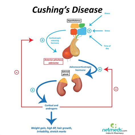 Cushings Syndrome Ideas Cushings Syndrome Cushings Cushing Disease | The Best Porn Website