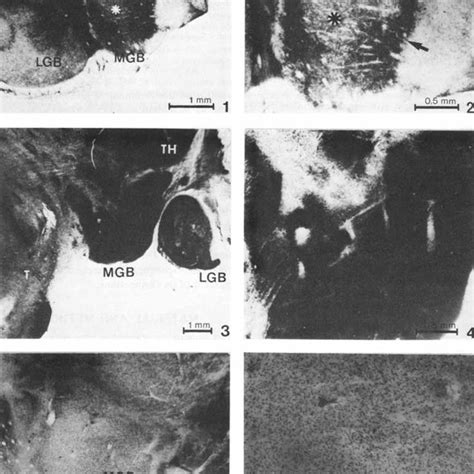 rind 2. Posterior thalamus and metathalamus in the 16.5-week-old human... | Download Scientific ...