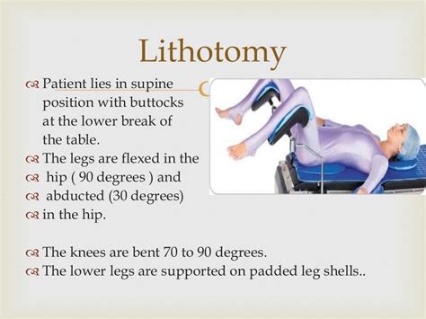 Lithotomy position abdullah