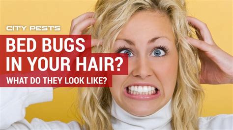 Bed Bugs In Hair | Symptoms, Pictures and Treatment for Bugs in Hair