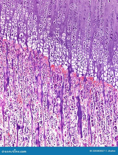 Endochondral Ossification. Growth Plate Stock Image - Image of ...