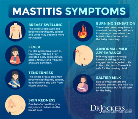 Mastitis During Breastfeeding: Symptoms and Support Strategies