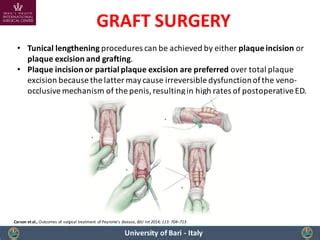 Peyronie's Disease: a tailored surgical procedure for every patient | PPT