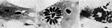 light microscopy of Toxoplasma gondii tachyzoites developing inside... | Download Scientific Diagram