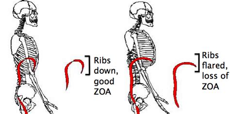 Rib Flare: Why it Sucks and Why You Should Care | Balance In Motion