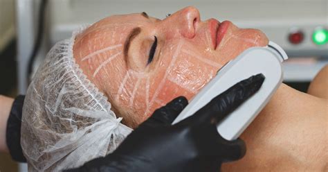 HIFU for Face Treatment: Benefits, Cost, Efficacy & More