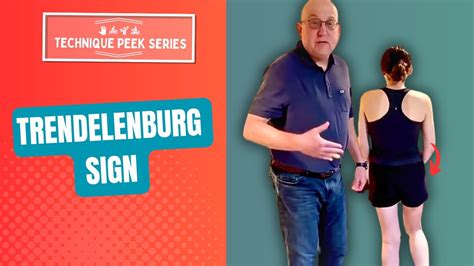 The Trendelenburg Sign | Technique Peek Series - YouTube