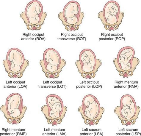 Pin by Tz Maung Maung on Pregnancy | Newborn nursing, Baby position, Nursing school survival