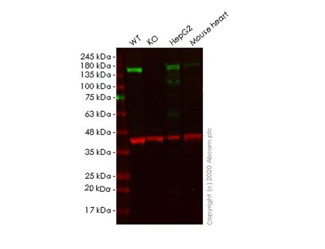 Recombinant Anti-Phospholipase C beta 1/PLCB1 antibody [EPR19085] - BSA and Azide free KO Tested ...