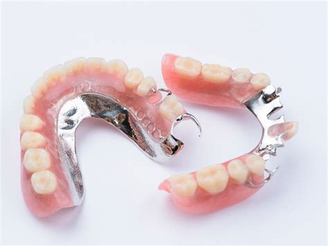 The Different Types of Dentures Available Today - Olds Denture & Implant Centre