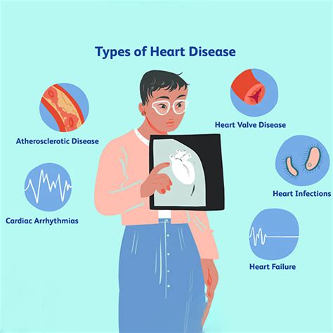 Heart Disease- Symptoms, Causes, Types, and Diagnosis