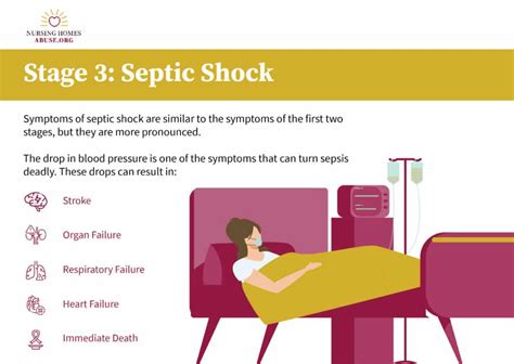 Three Stages of Sepsis: Sepsis, Severe Sepsis, and Septic Shock