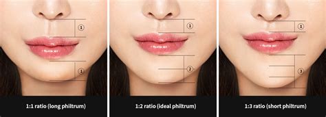 What is the purposes of the philtrum - treelas