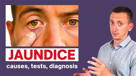 A Clinical Approach to Jaundice - YouTube