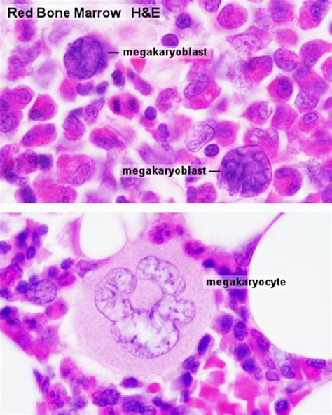 File:Bone marrow histology 03.jpg - Embryology