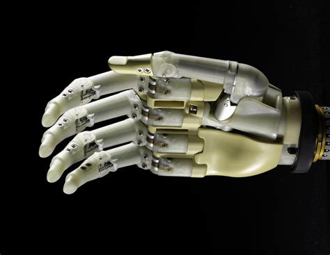 Reconstructing Lives: How does a prosthetic hand work? | National Museums Scotland Blog