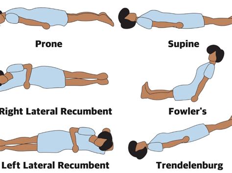 lateral recumbent position - Google Search | Radiology student ...