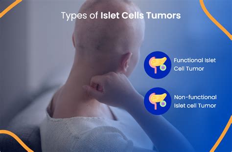 Islet Cell Cancer: Everything You Need To Know | ACTC