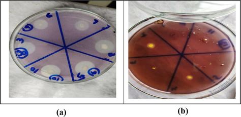 (a) Pectinase producers and (b) non-producers. | Download Scientific ...